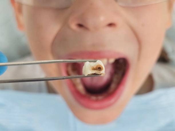 Best Emergency Cosmetic Dentistry (e.g., broken veneers) in Holland, TX