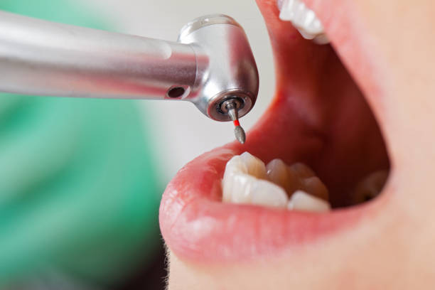 Best Emergency Denture Repair in Holland, TX